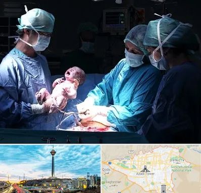 جراح سزارین در تهران