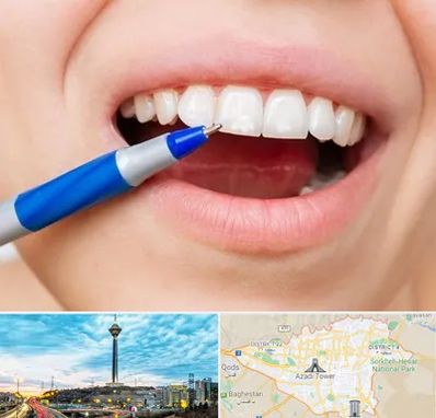 دندانسازی ارزان در تهران