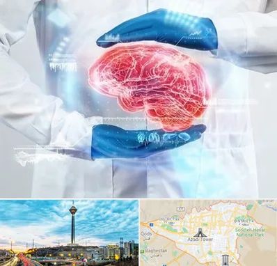دکتر مغز و اعصاب در تهران