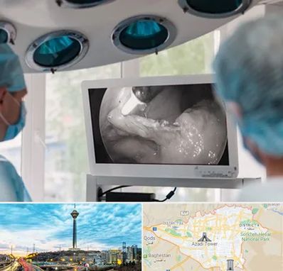 جراح ریه در تهران