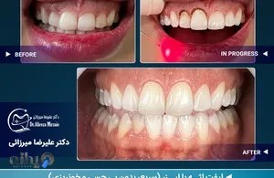 دندانپزشکی دکتر علیرضا میرزایی