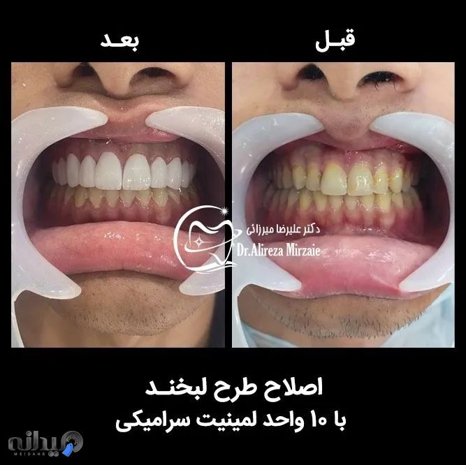 دندانپزشکی دکتر علیرضا میرزایی