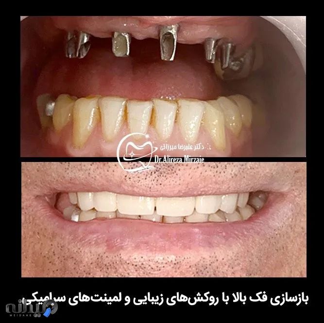 دندانپزشکی دکتر علیرضا میرزایی