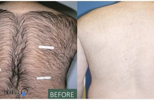 مرکز زیبایی و لیزر آسمان