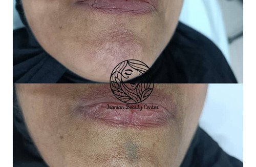  ایرانیان بیوتی سنتر