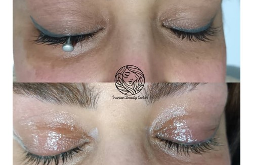  ایرانیان بیوتی سنتر