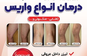 متخصص قلب و عروق