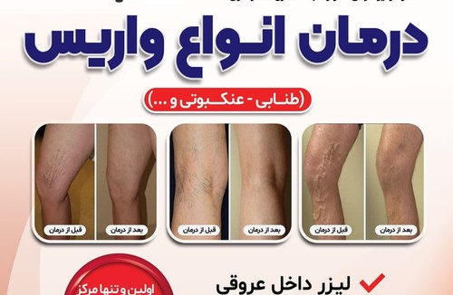 متخصص قلب و عروق