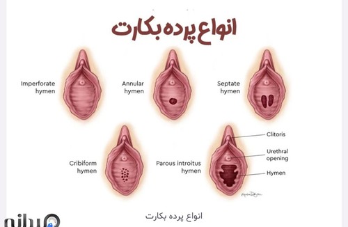 زنان و مامایی