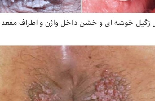 زنان و مامایی