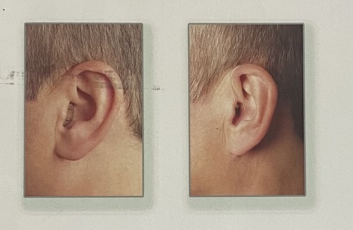 شنوایی سنجی دکتر بهنوش کمالی