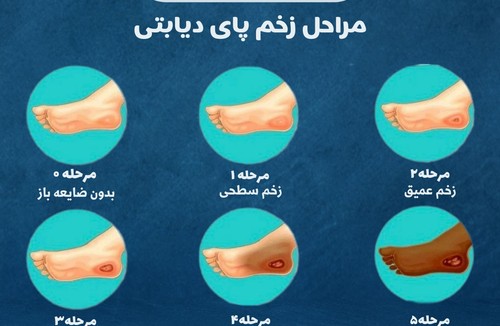 کلینیک زخم پرند ( طاها قادری)