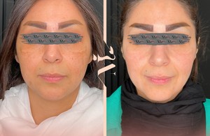 مرکز پزشکی و زیبایی میروژ سنتر