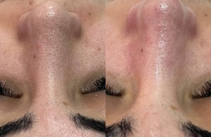 بهترین پاکسازی پوست 