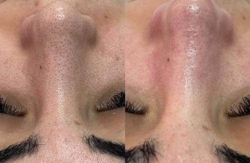 بهترین پاکسازی پوست 