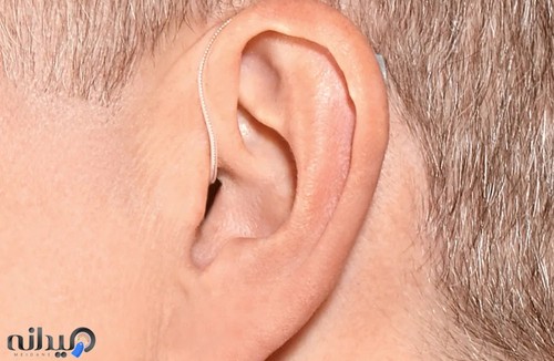 شنوایی سنجی و سمعک رسا