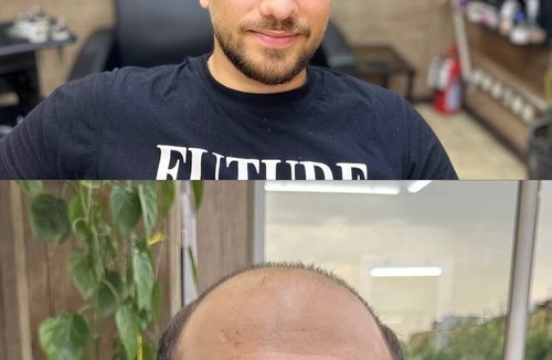 کلینیک پروتز موی یاسین بیاتی