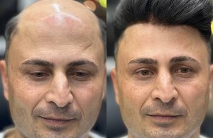 کلینیک پروتز موی یاسین بیاتی