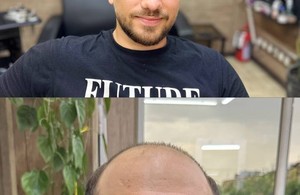 کلینیک پروتز موی یاسین بیاتی