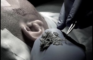 کلینیک کاشت مو و ابرو ام ار ای