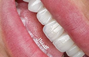 کلینیک دندانپزشکی گلدنتال