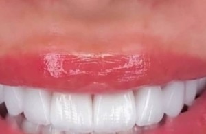 کلینیک دندانپزشکی گلدنتال