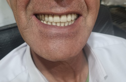 دندانسازی