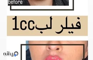 کلینیک پوست و مو لیزر 