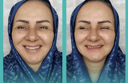 دندانسازی روشنا