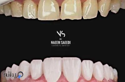 دندانپزشکی دکتر نعیم سعیدی
