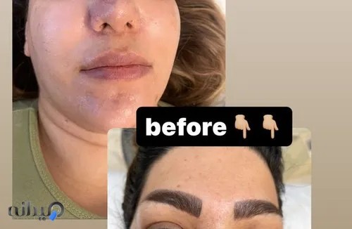 مراقبتهای زیبایی پوست فنی حرفه ای و تالگو فرانسه