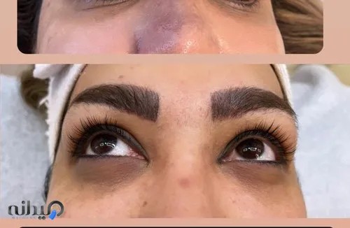 مراقبتهای زیبایی پوست فنی حرفه ای و تالگو فرانسه