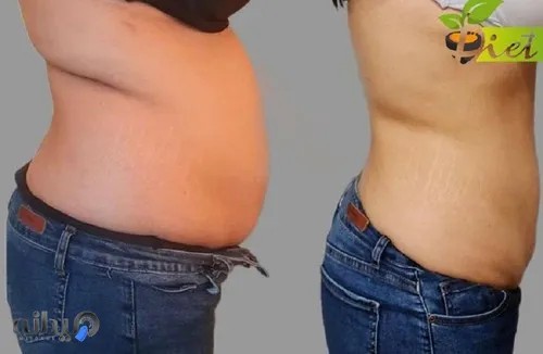 کلینیک لاغری،تغذیه و رژیم عسل بندرعباس