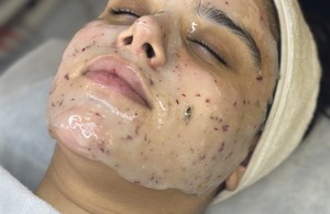 پاکسازی وفیشال پوست