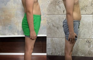 حرکات اصلاحی