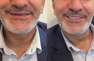 دندانسازی اسماعیلی