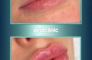 کلینیک درمانی زیبایی آینا