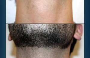 کلینیک درمانی زیبایی آینا