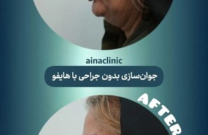 کلینیک درمانی زیبایی آینا