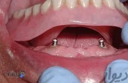 دندانسازی سلامت 