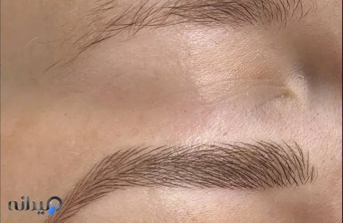 بهار پیگمنت