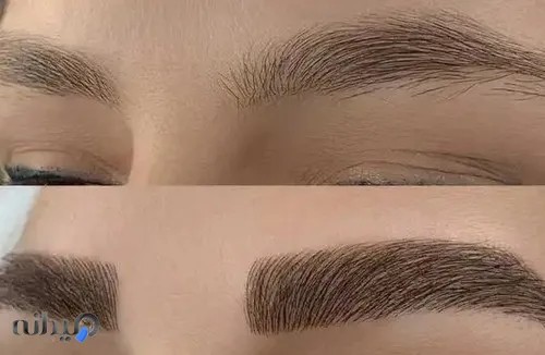 بهار پیگمنت