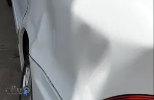 تکنوصافکاری PDR حسین اکبرزاده