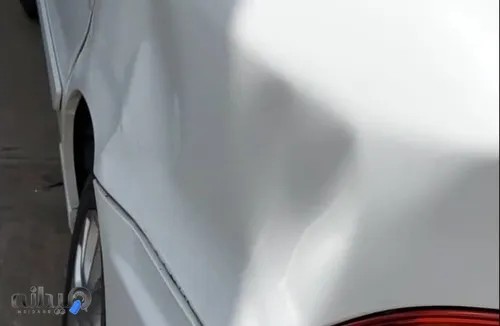 تکنوصافکاری PDR حسین اکبرزاده