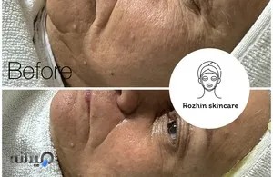 خانه پوست گوهردشت