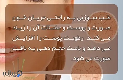 کلینیک طب سوزنی فرمانیه