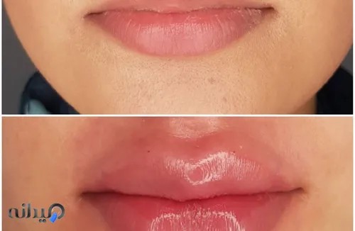 کلینیک لیزر دکتر عاصمی