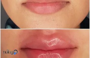 کلینیک لیزر  دکتر عاصمی