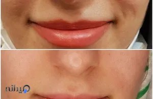 کلینیک لیزر  دکتر عاصمی