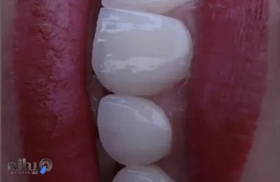 مطب دندانپزشکی دنیا رشنو